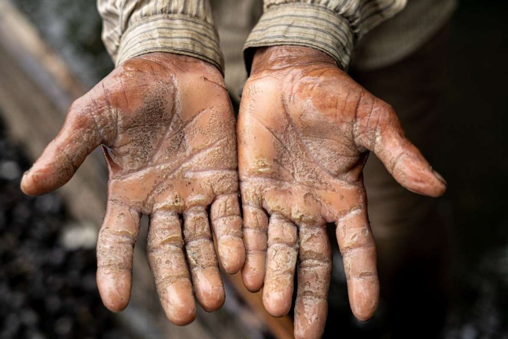 Weathered Hands A pair of rough, weathered hands covered in salt and dirt.